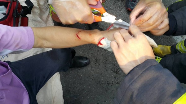 手夾切菜機 國小廚工手指險斷