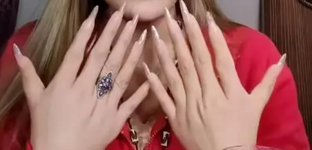 女子天生雙手共12根手指,家中姐弟多人是「六指」,醫生解讀