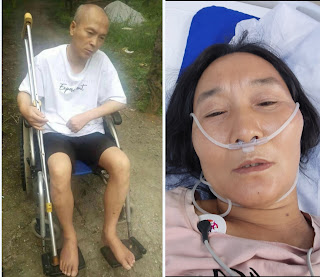獲刑4年6個月的淋巴癌晚期患者、維權人士尹登珍女士被連續剝奪正常醫療救治100天